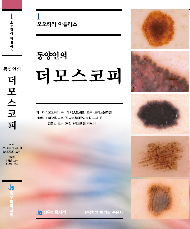허창훈 교수 역서 ‘동양인의 더모스코피’ 