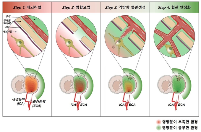 아주대병원 신경과 홍지만 교수팀이 막힌 혈관과 상태가 좋은 혈관을 연결해 치료하는 새로운 치료법을 발표했다. 연구팀에 따르면 문제가 되는 막힌 혈관이 아닌 두개골 외(外) 위치한 정상 혈관에 혈관재생을 돕는 약물을 투여, 이 두 혈관을 가로 막고 있는 두개골에 작은 구멍을 내는 두 개 천공술을 시행한 결과 그림(위)과 같이 두 개의 혈관이 연결되고 점차 혈류가 안정적으로 흐르는 것을 확인했다. 원래 상태가 좋지 않은 혈관은 치료가 힘들지만, 이 혈관이 상태가 좋은(혈류가 풍부하고 건강한) 혈관과의 연결로 점차 혈류가 원활해지면서 증상이 호전됐다. (사진=아주대병원 제공)