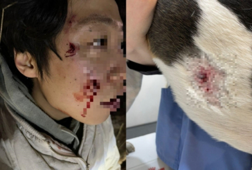 로트와일러에게 공격 받아 피투성이가 된 피해자와 그의 반려견. (사진=온라인 커뮤니티 캡처)