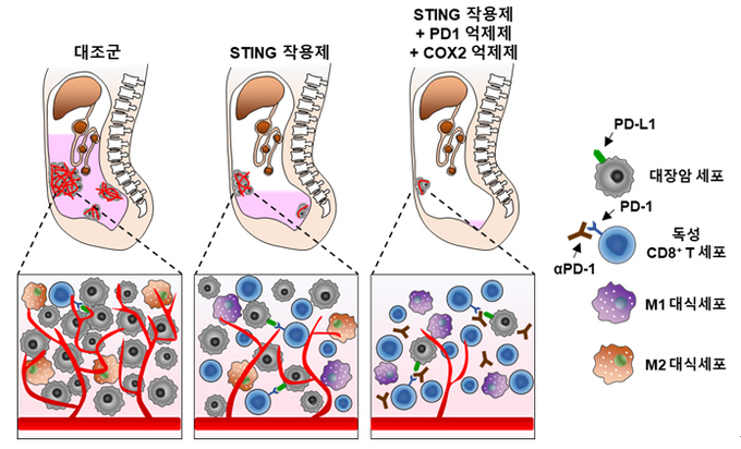 스팅 치료 후 면역 킬러세포인 CD8 T세포(파란색)가 증가하며, 면역억제세포인 M2대식세포(붉은색)가 감소함을 확인할 수 있다. (사진=분당 차병원 제공)