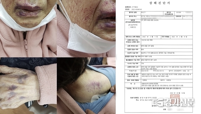 A씨가 공개한 할머니의 피해 모습과 상해진단서 (사진=온라인 커뮤니티 캡쳐)