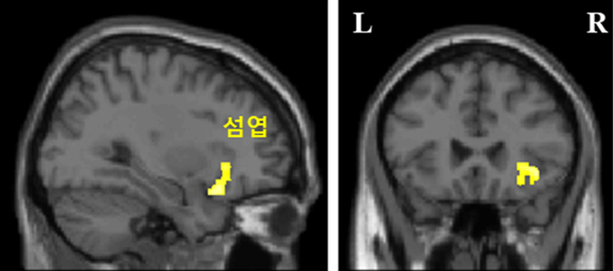 행복감 뇌 부위. (사진=분당 차병원 제공)