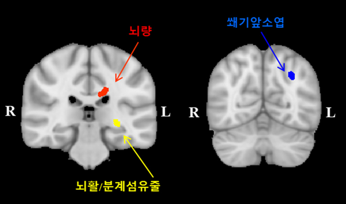 행복감 뇌 부위. (사진=분당 차병원 제공)