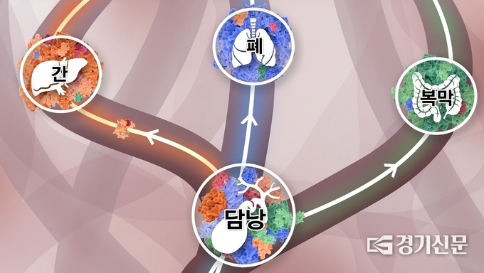 담낭에 다양한 클론들이 섞여 있다가 주황색 클론이 이긴 암세포는 간으로, 파란색 클론이 이긴 암세포는 폐로, 초록색 클론이 이긴 암세포는 복막으로 간다. (연구사진=분당서울대병원 제공)