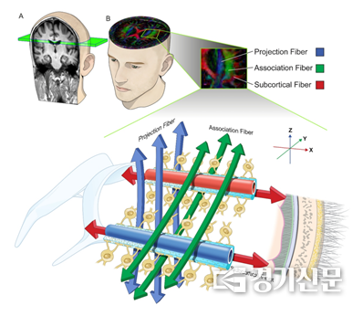 혈관주위 뇌 글림프 흐름 반영하는 주위 공간의 확산지수 관련 원리를 보여주는 모식도. (사진=분당서울대병원 제공)