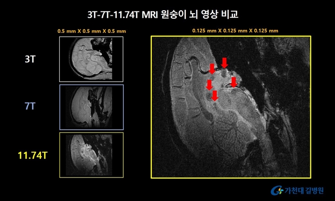 원숭이 뇌 영상 비교 MRI. ( 사진 = 가천대 길병원 제공 )