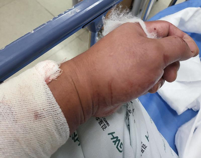  김포시의 한 아파트에서 작업 중 부상을 입은 작업자 40대 A씨. (사진=연합뉴스 제공)