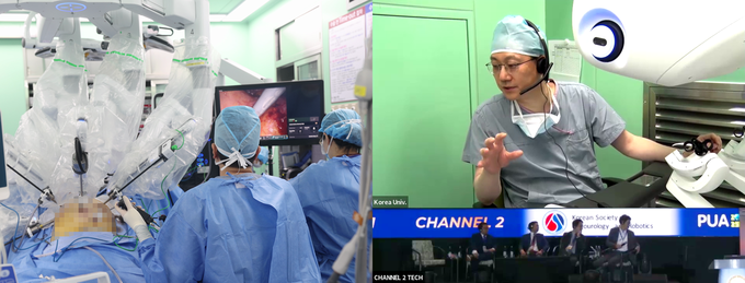 강석호 고려대 안암병원 교수, 필리핀 국제학회서 방광암 로봇수술 원격 라이브 시연